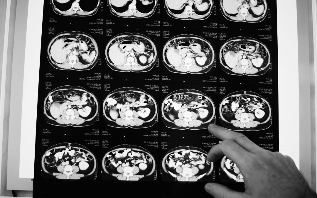 Aptatargets – ApTOLL