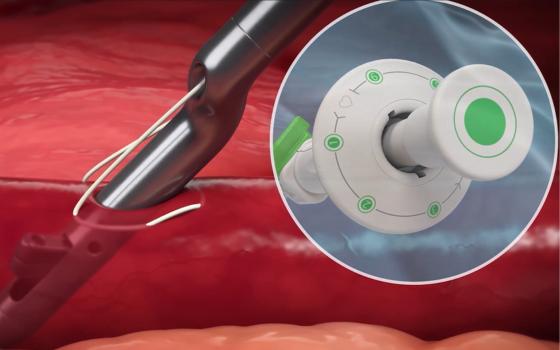 Featured_Image_Novelrad