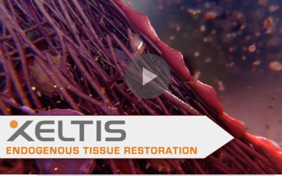 Xeltis Success Story